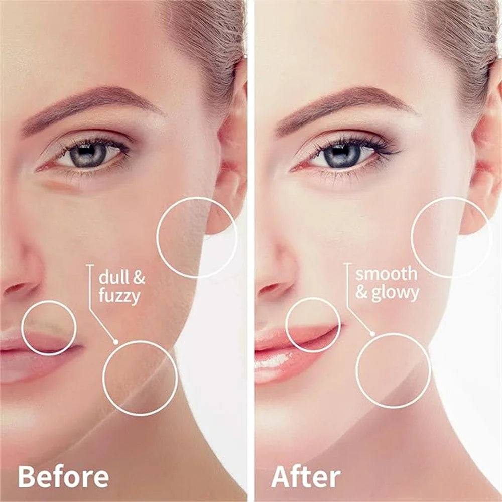 Removedor Facial USB Recargable – Edición Rose Gold